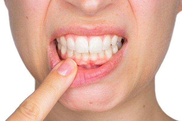 Can An Endodontist Treat Inflamed Gums?